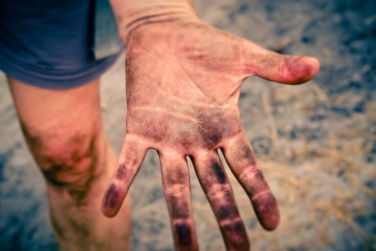 白髪染めの皮膚に付いた汚れを簡単に落とす方法は？